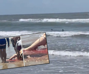 ABD'de halk plajında köpekbalığı dehşeti: 4 yaralı
