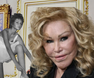 Kocasından kalan serveti, kediye benzemek için estetik ameliyatlara yatıran Jocelyn Wildenstein 84 yaşında hayatını kaybetti