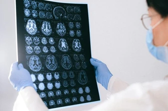 Bilim insanları Alzheimer’ın beyin hücresi ölümüne yol açan temel proteini belirledi