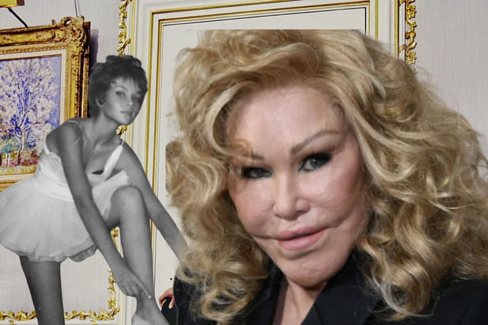 Kocasından kalan serveti, kediye benzemek için estetik ameliyatlara yatıran Jocelyn Wildenstein 84 yaşında hayatını kaybetti