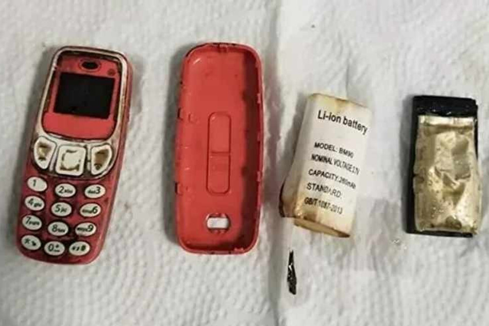 33 yaşındaki erkeğin midesinden Nokia 3310 çıktı!