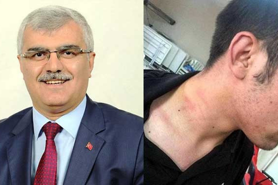 AKP’li vekil tartıştığı CHP’li gencin boğazını sıktı, daha sonra özür diledi