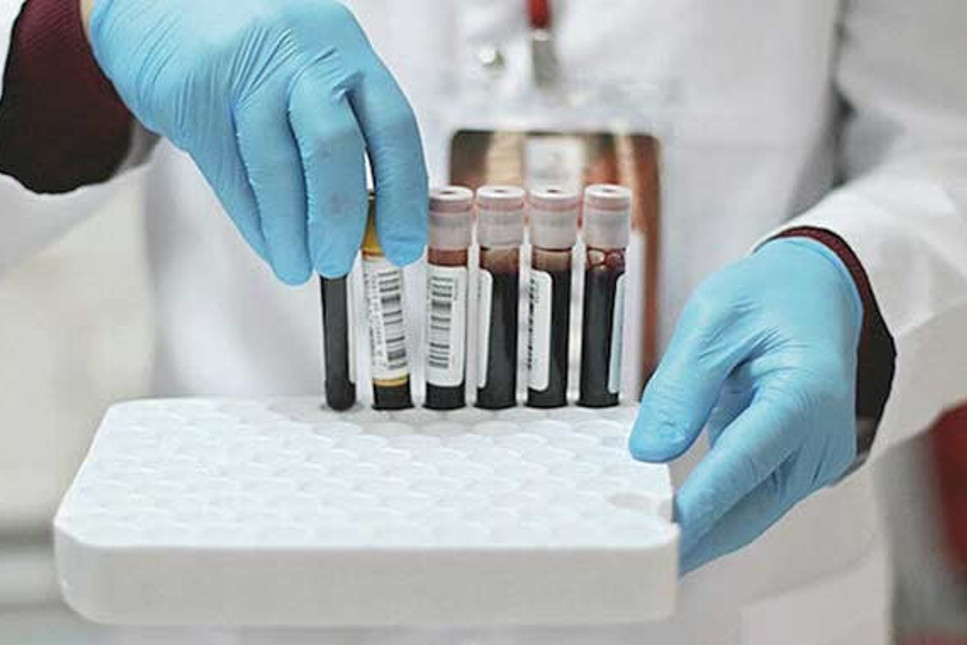 Yurtdışına çıkanlar PCR testi için IBAN’a para yatıracak