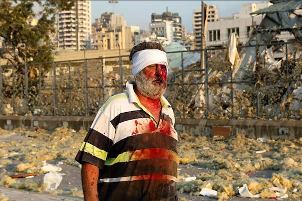 Beyrut'da meydana gelen patlamada maddi hasar 15 milyar doları aştı