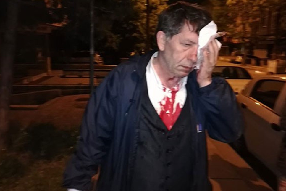 Ünlü gazeteci evinin önünde saldırıya uğradı