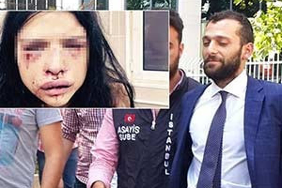 Onur Özbizerdik'in kız arkadaşı dehşet anlarını anlattı: 400 Bin Dolara serbest kalmış